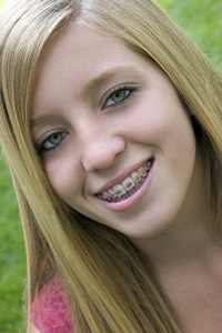 photo of girl wearing braces